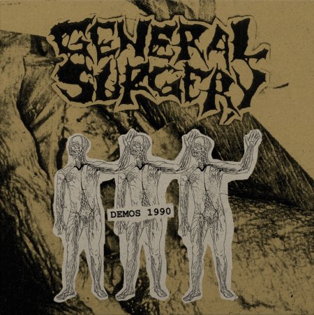 GENERAL SURGERY - Demos 1990 LP (DIEHARD)